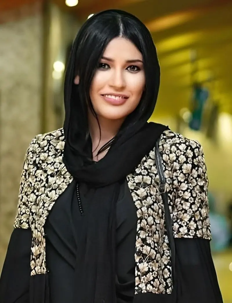 شیوا طاهری قبل از عمل زیبایی